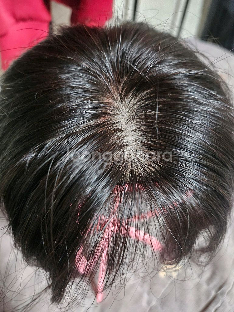 인모 부분가발--1