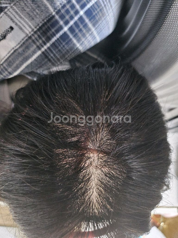 인모 부분가발--4