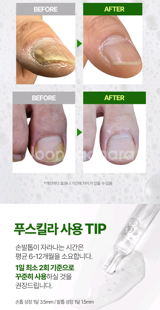 리즈 푸스킬라 손,발톱 리페어 세럼 영양제 30ml 새상품--2