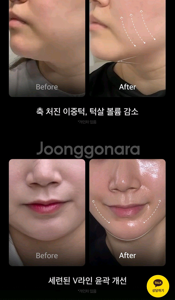 메디큐브 하이포커스샷 미개봉 새상품 풀박스+PDRN 전용 젤--5