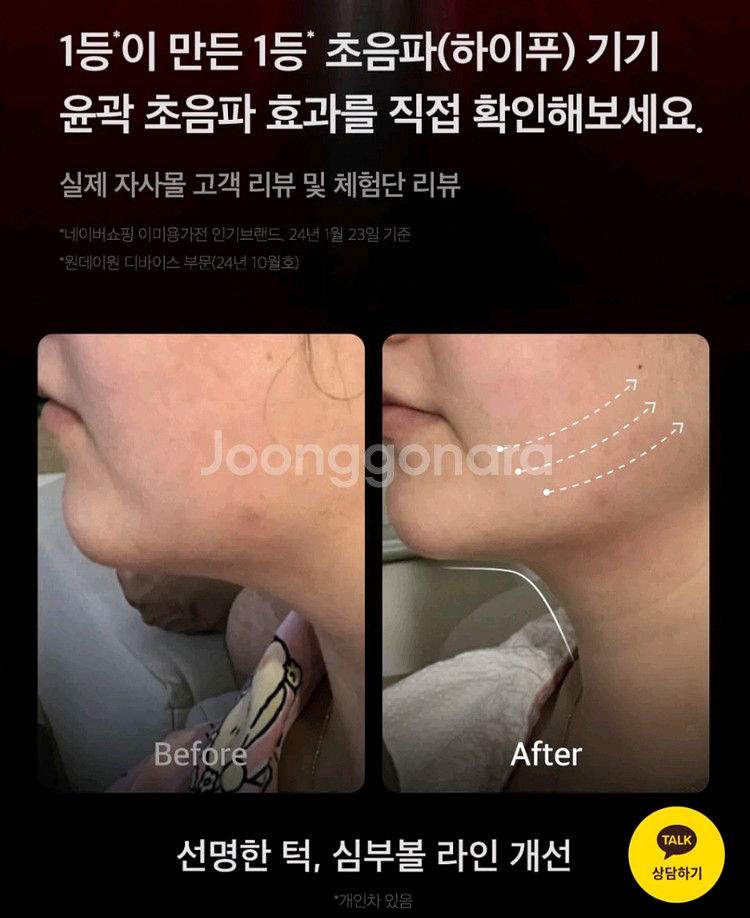 메디큐브 하이포커스샷 미개봉 새상품 풀박스+PDRN 전용 젤--4