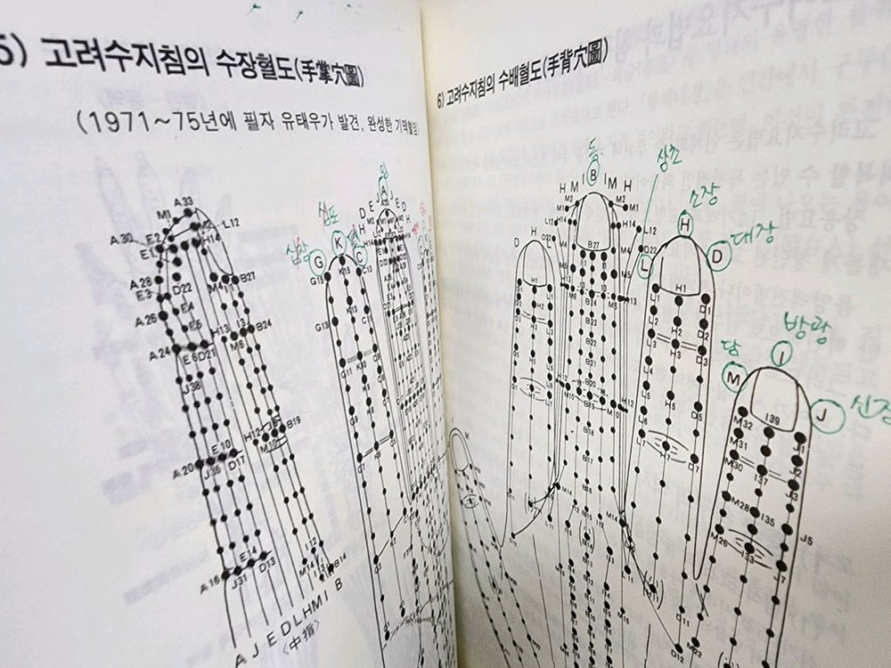 고려 수지침 교본--2