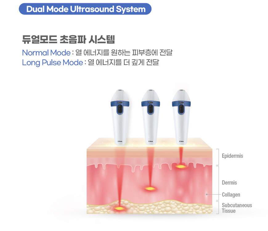 롱펄스 초음파 리프팅기기 원쎄라--2