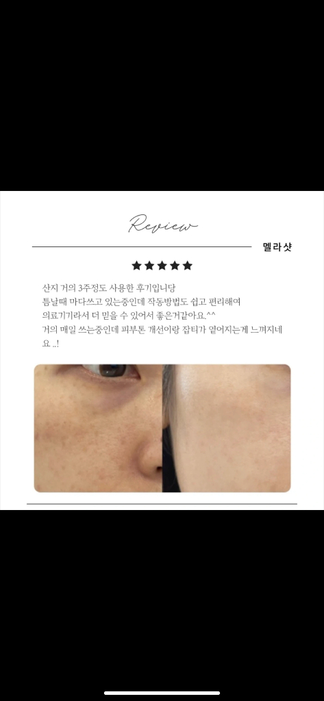 성분에디터 멜라샷 IPL 미백 기미 색소침착 마스크--2