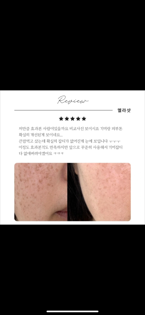 성분에디터 멜라샷 IPL 미백 기미 색소침착 마스크--3