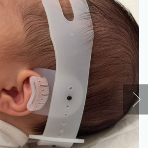 메딧트 메디톡 메디핏 신생아 귀교정기