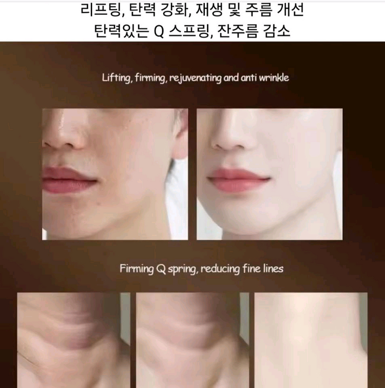 초음파 목주름 관리기--5