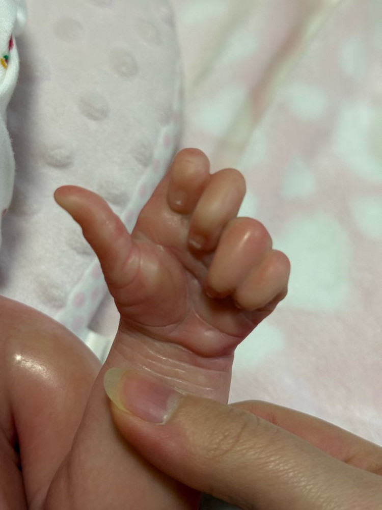 풀 실리콘 리본돌 이미지