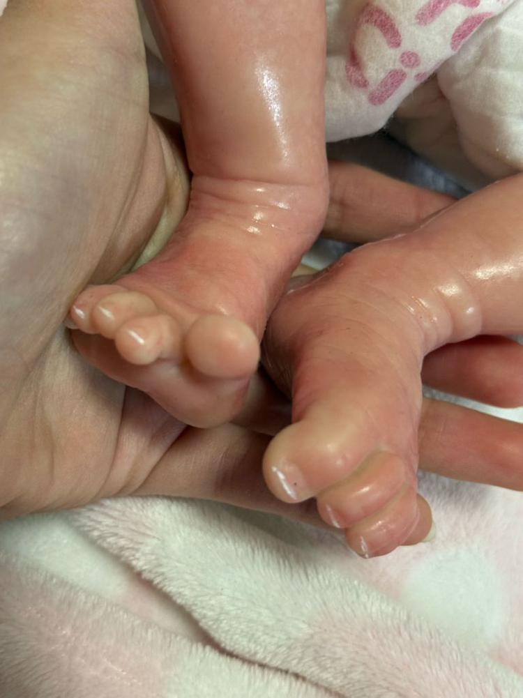 풀 실리콘 리본돌 이미지