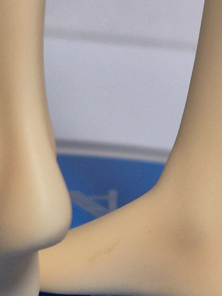 페어리테일 유키노 아그리아 1/7 스케일 피규어--4