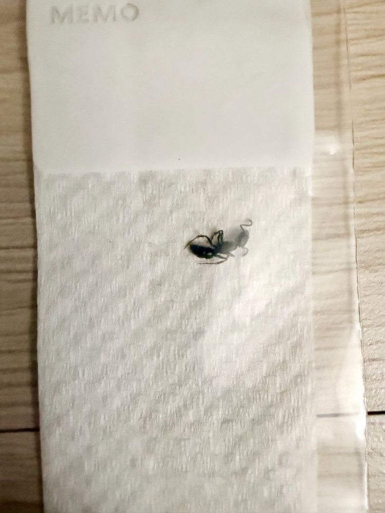 일본침개미 A표본 이미지