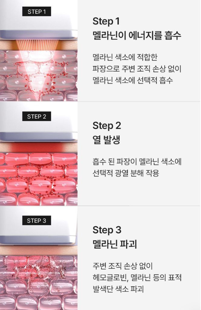 성분에디터 멜라샷(미백디바이스기기)최저가!!--1