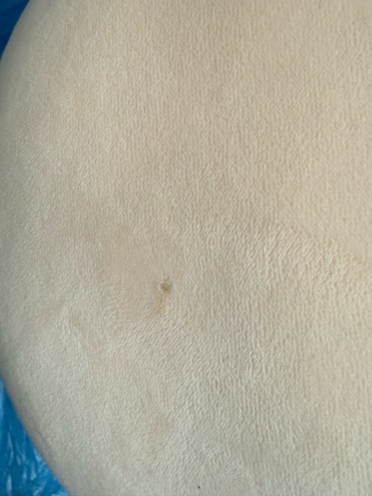 데이식스 자이언트 데니멀즈 일괄--3