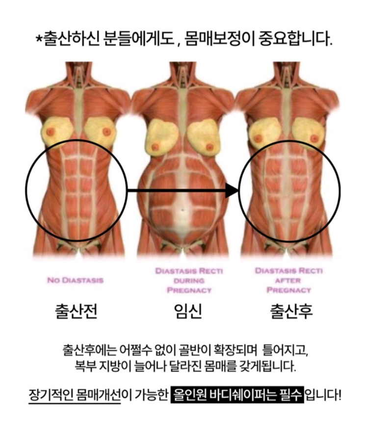 겔로벨 올인원 바디쉐이퍼 스킨 L--2