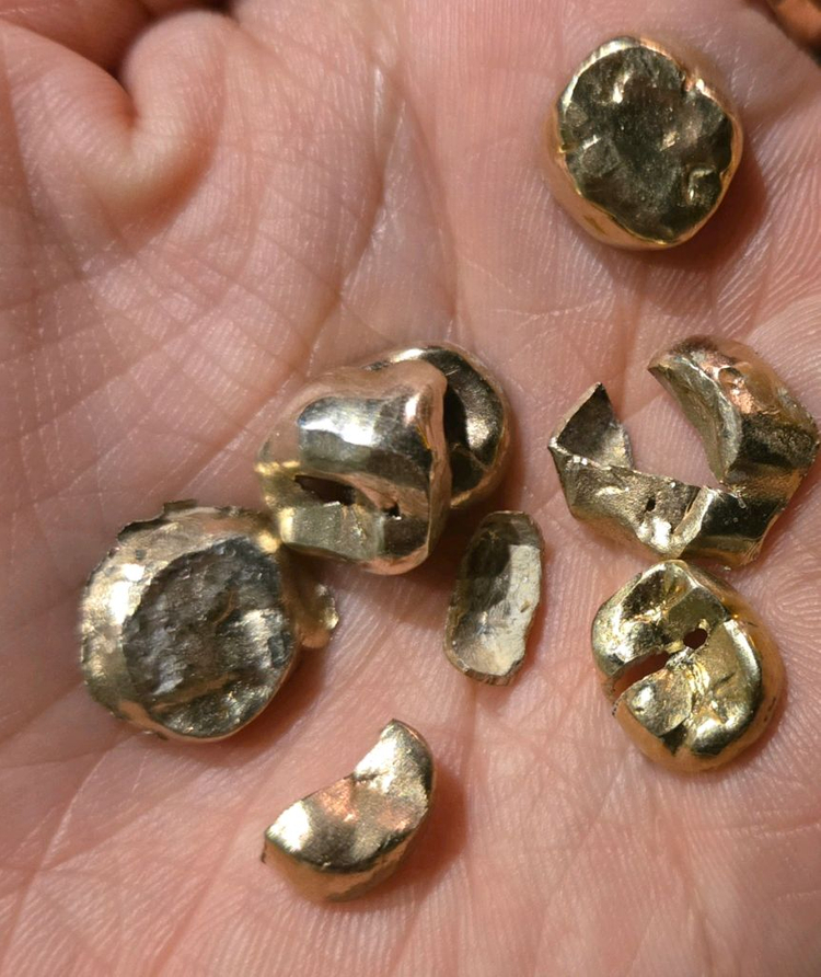 금니 최고가로 삽니다--1