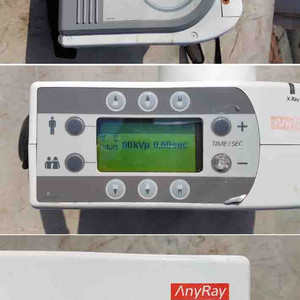 휴대용 X-ray 스캐너 이미지