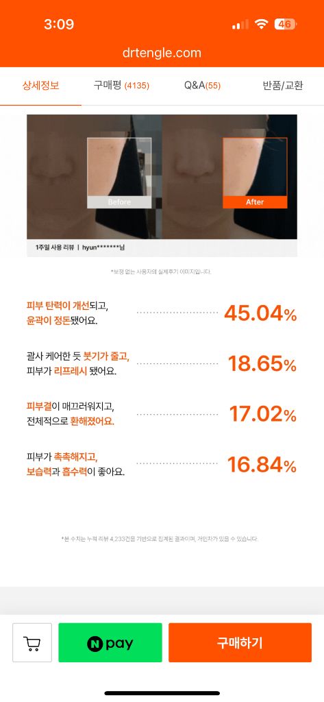 풀세트) 닥터탱글 고주파 5회정도 사용(미개봉 파우치 및 소독티슈 일괄) 택포--5