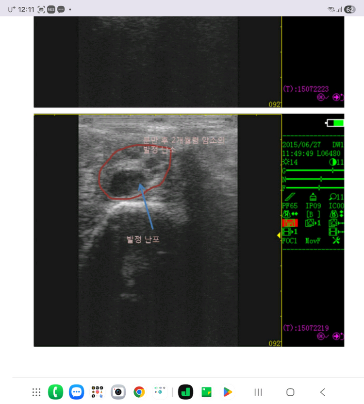 송강 대가축용(한우 젖소)초음파 임신진단기 이미지