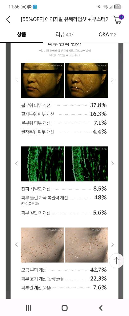 메디큐브 에이지알 유쎄라 딥샷--5