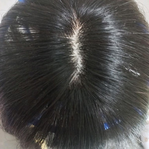 에이위그 인모 부분 가발/ 앞머리 가발 / 정수리 가발