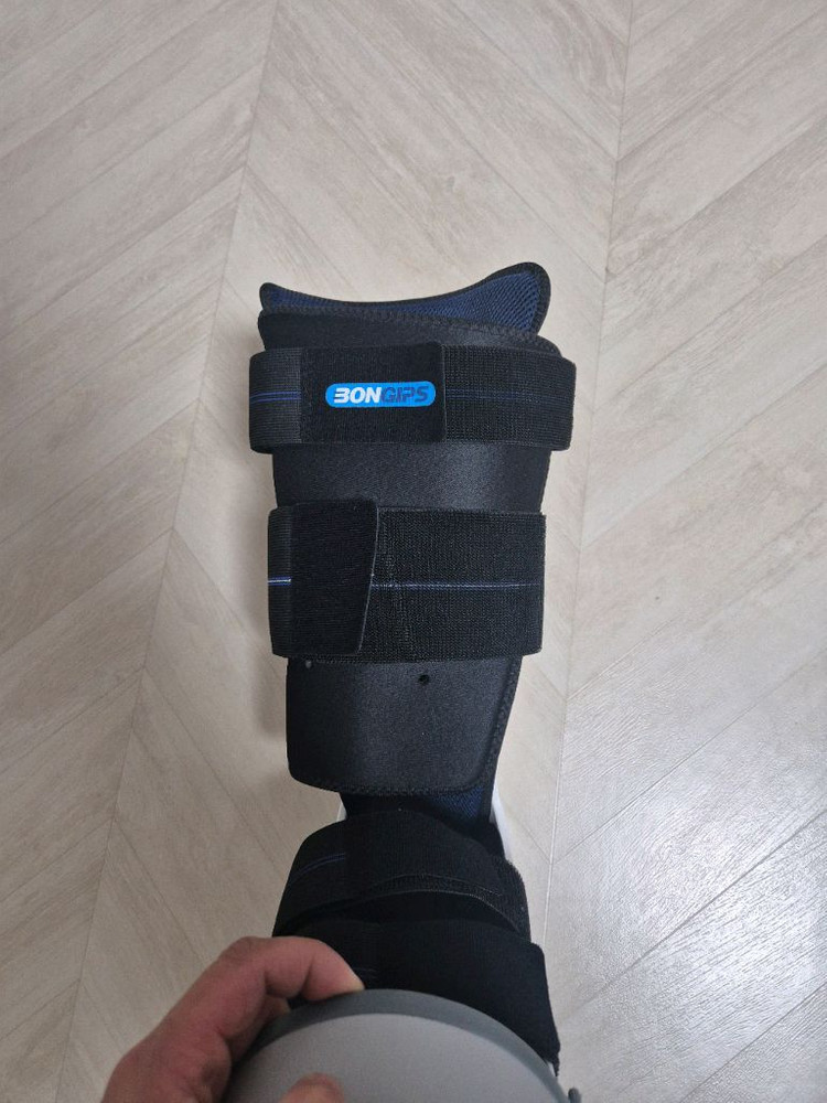 본깁스 발목--2