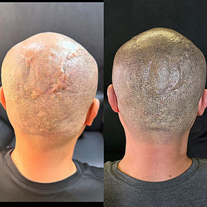 탈모 케어 이미지