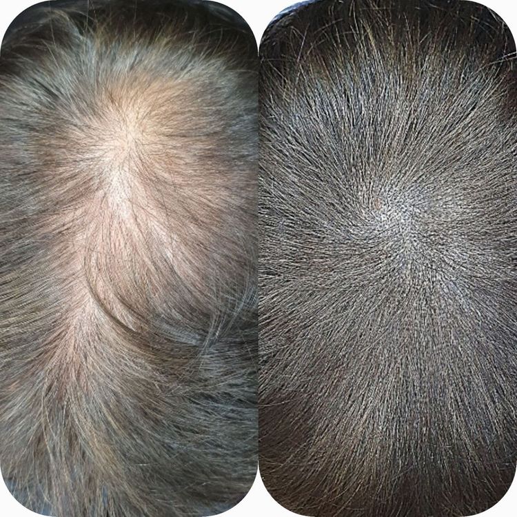 탈모 케어 이미지