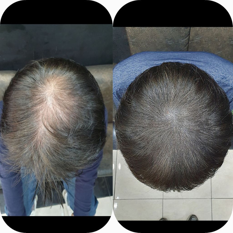 탈모 케어 이미지