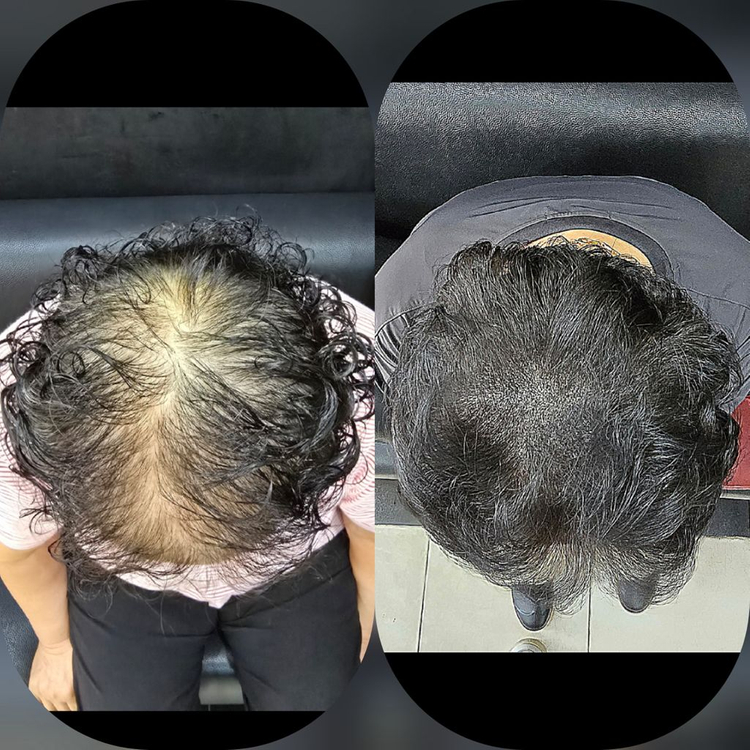 탈모 케어 이미지