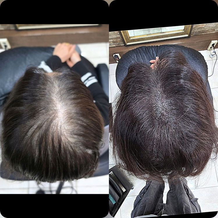 탈모 케어 이미지