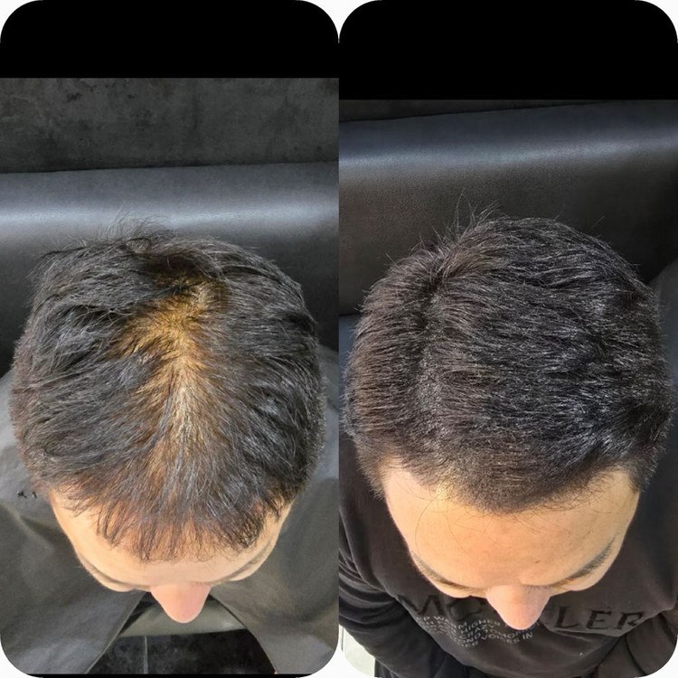 탈모 케어 이미지