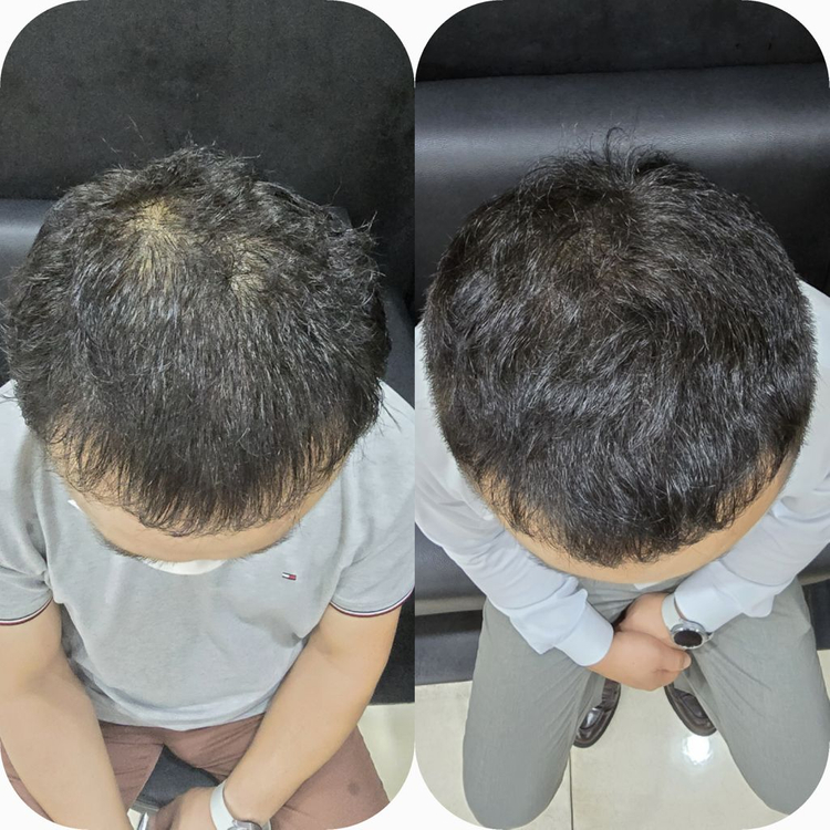 탈모 케어 이미지