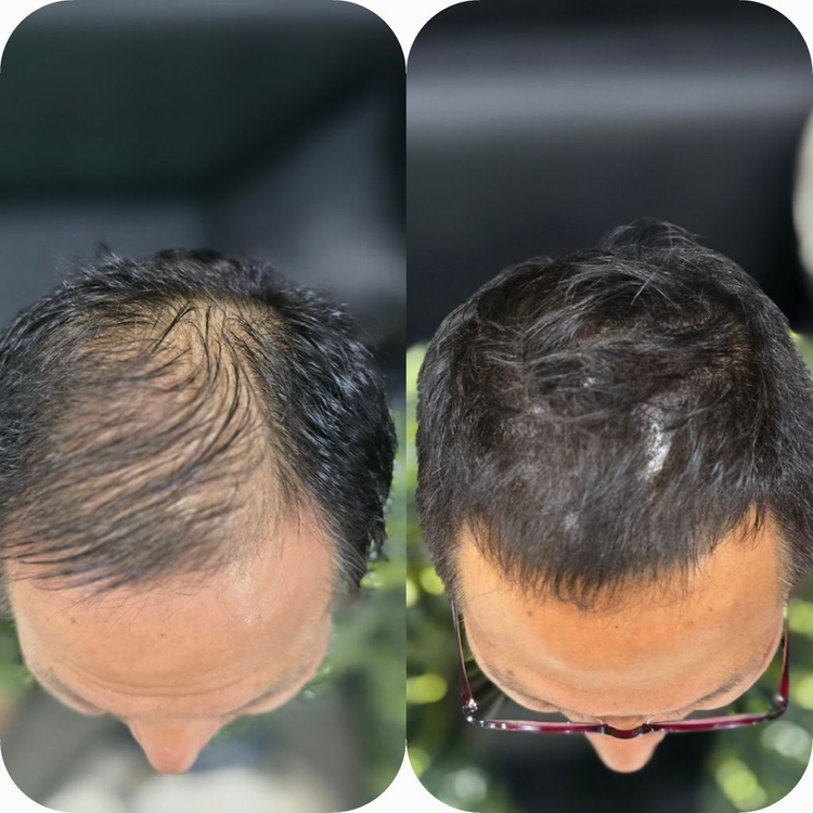 탈모 케어 이미지