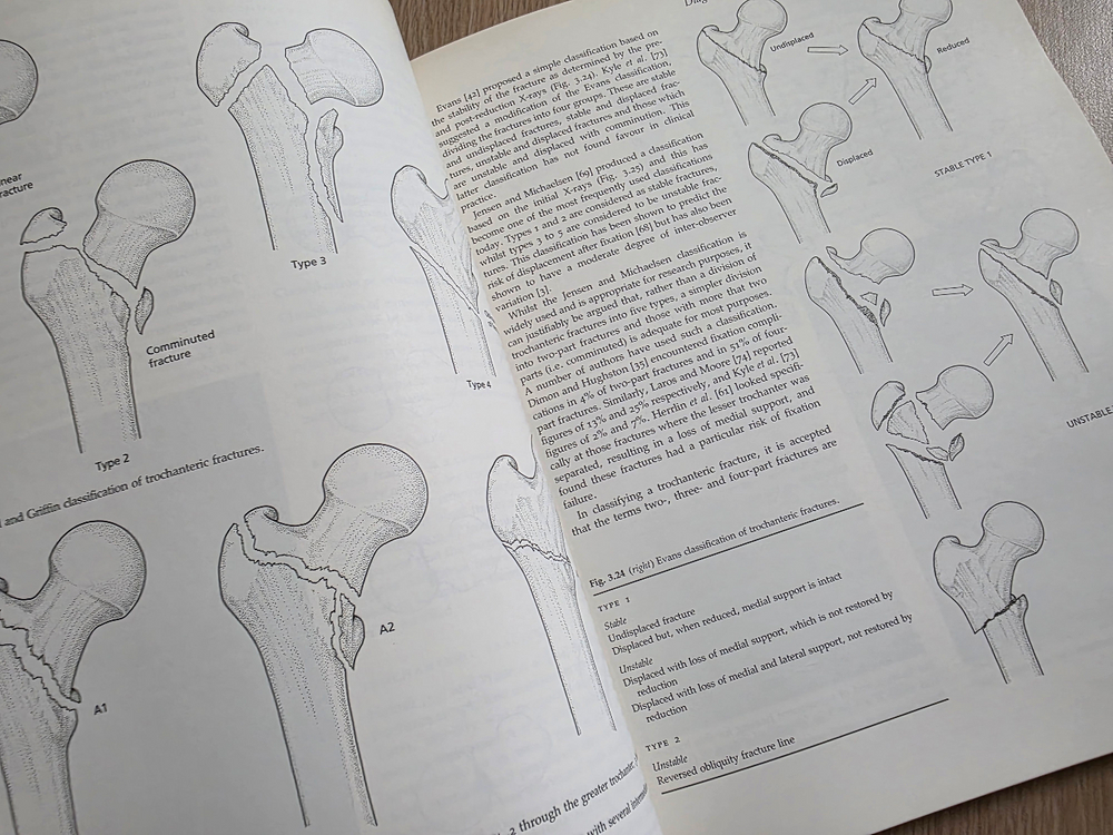 의학서적 Hip Fracture Management 이미지