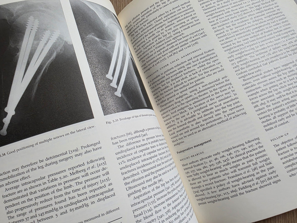 의학서적 Hip Fracture Management 이미지