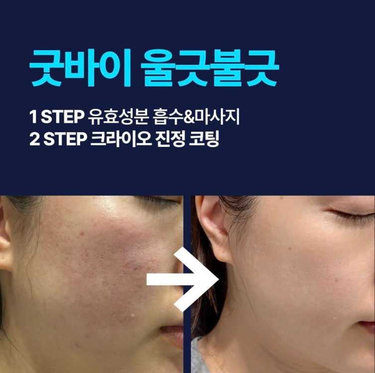 일오구구 크라이오셀 모종쫀쫀 끝판왕 이미지