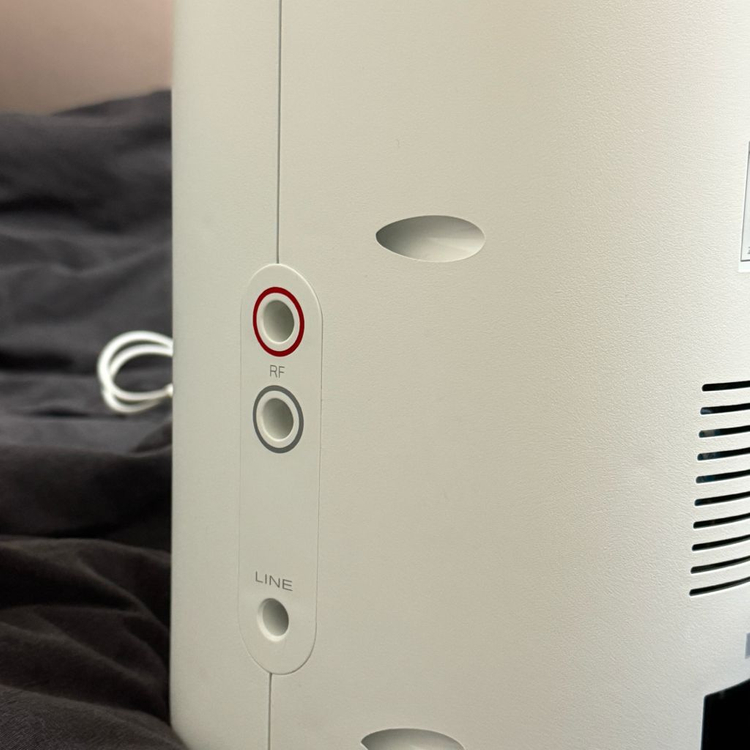 네오알파 고출력 300와트 고주파 피부관리기기 이미지