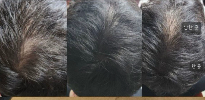 헤어미용기기 세트 이미지
