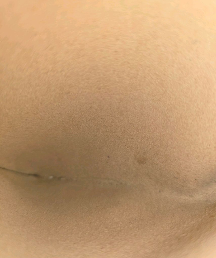 구찌 오피디아파우치 이미지