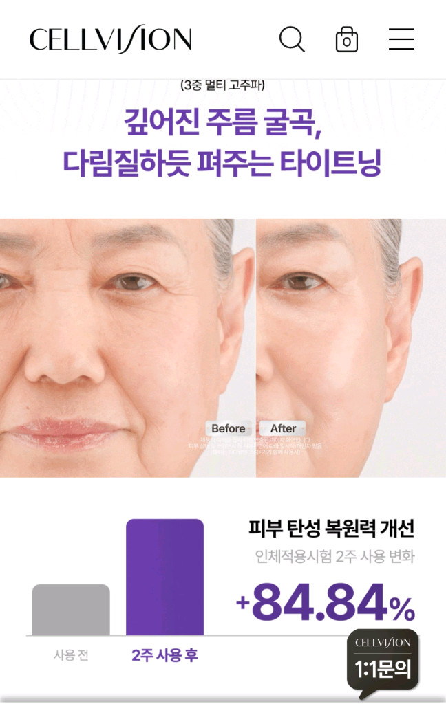 셀비전 미용기기 이미지