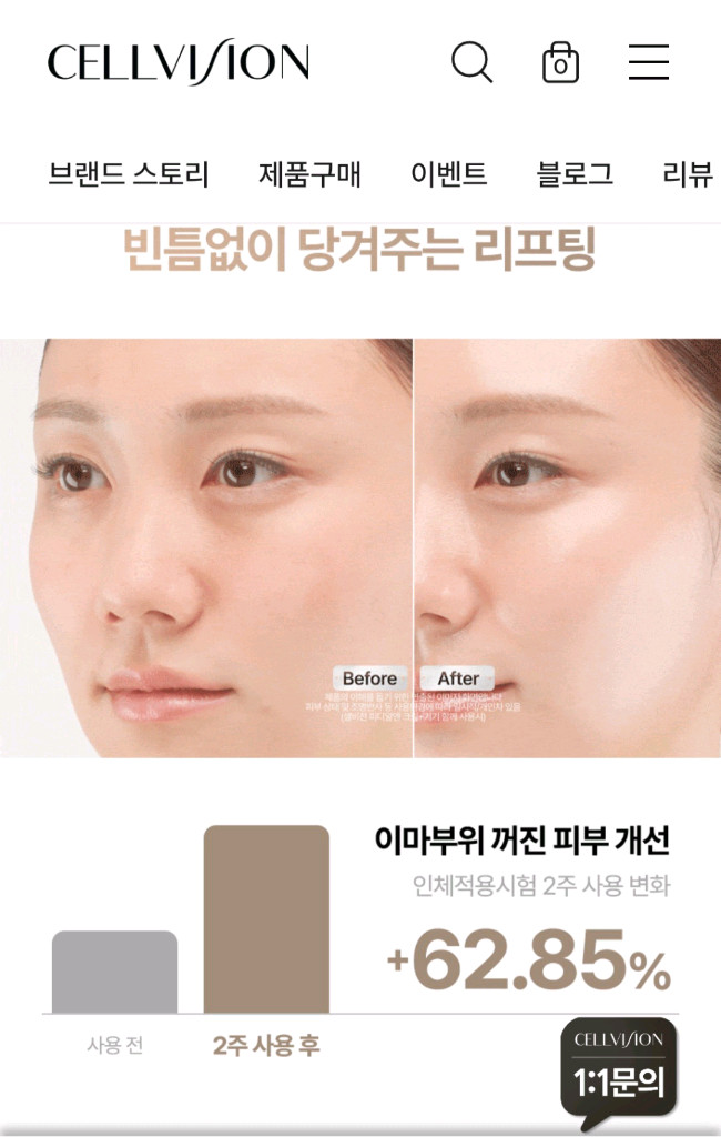 셀비전 미용기기 이미지