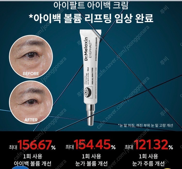 닥터멜락신 아이팔트 아이크림 (3회 사용) 이미지