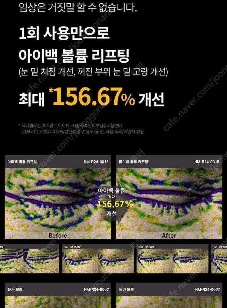 닥터멜락신 아이팔트 아이크림 (3회 사용) 이미지