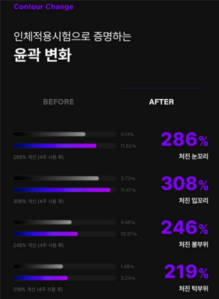 아옳이 세라매스 델 뷰티디바이스 세트고주파 고전압 홈케어 피부관리기 이미지