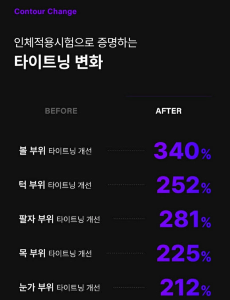 아옳이 세라매스 델 뷰티디바이스 세트고주파 고전압 홈케어 피부관리기 이미지