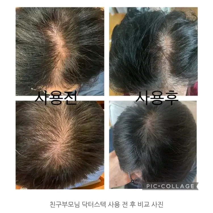 암웨이 L400 두피/탈모 레이저 치료기 이미지
