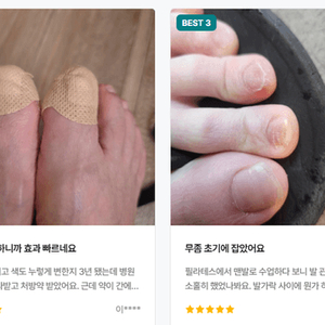 안티무조 발장벽앰플 3개 이미지