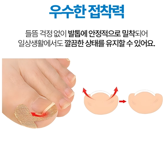 내성발톱 관리 밴드 200매입 살파고듬 방지 이미지