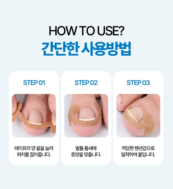 내성발톱 관리 밴드 200매입 살파고듬 방지 이미지