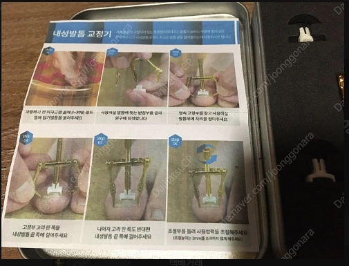 Dr.NC 닥터엔씨 내성발톱 교정기 이미지